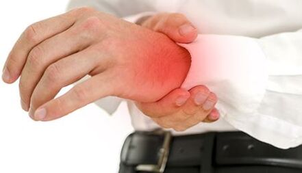 sāpes plaukstas locītavā ar artrītu un artrozi