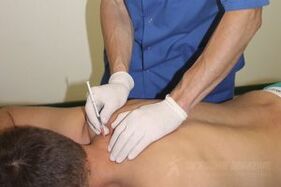Pasīva osteohondrozes ārstēšana