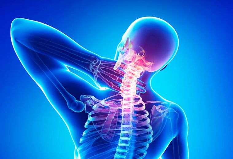 Mugurkaula kakla mugurkaula osteohondroze
