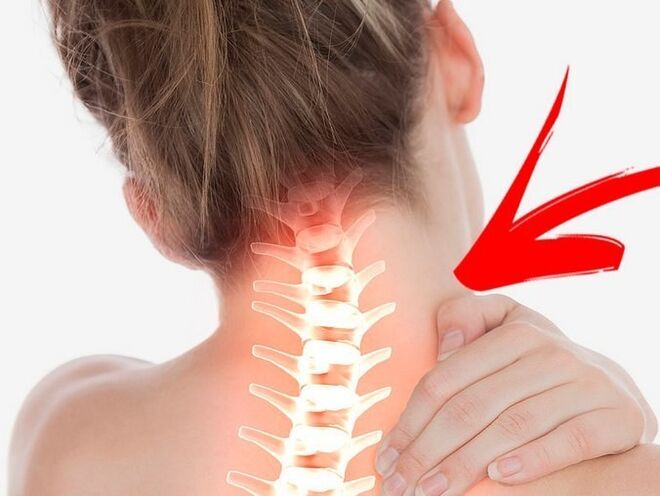 Nervu sakņu saspiešana ar dzemdes kakla osteohondrozi