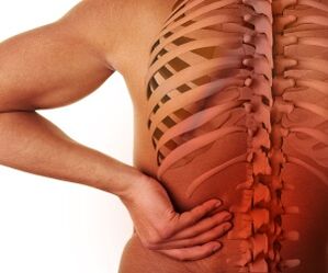 muguras sāpes ar jostas daļas osteohondrozi